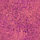 Textures 171